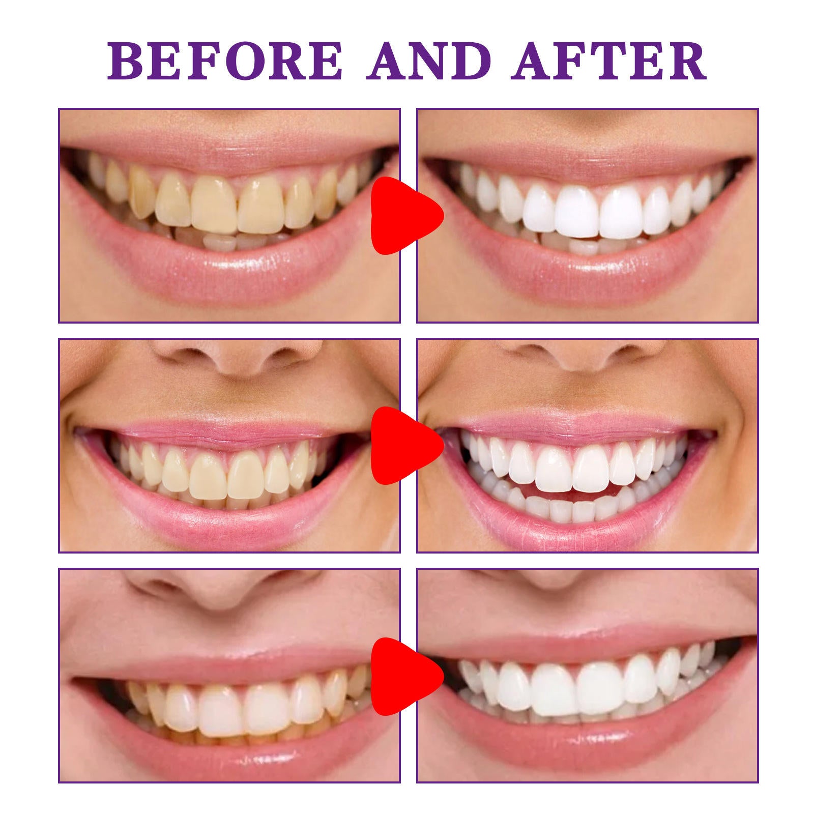Purple Corrector Toothpaste - Color-Correcting Brightening Toothpaste
